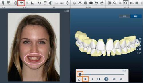 国产牙套评测视频播放网站,揭秘热门品牌性能与价格对比